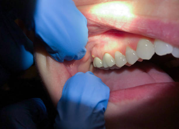 Best Dentist for Dental Trauma  in Harlem Heights, FL